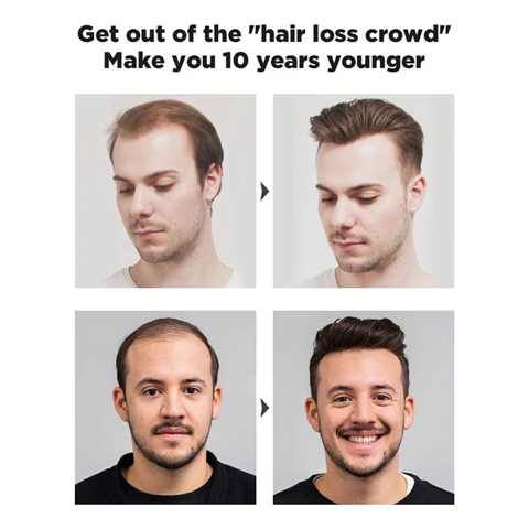 Kirkland Signature 5% Миноксидил для роста волос у мужчин, 6 упаковок