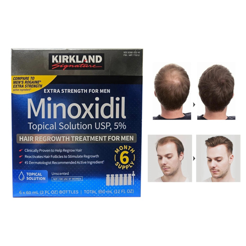 Kirkland Signature 5% Миноксидил для роста волос у мужчин, 6 упаковок